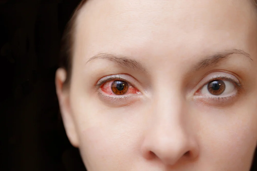 Prevenção de Doenças Oculares: Como Proteger a Sua Visão